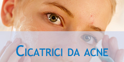 Trattamento delle cicatrici da acne